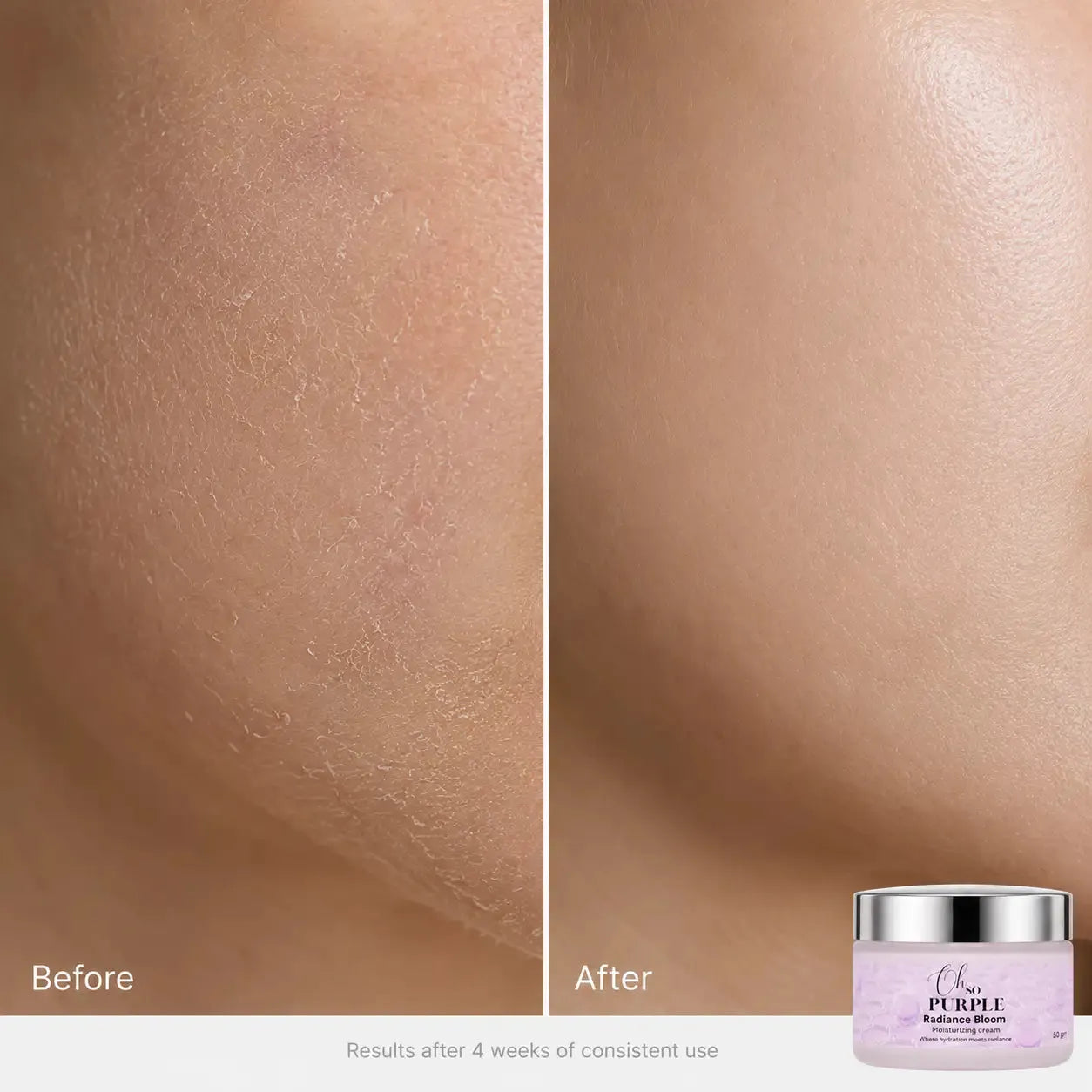 Radiance Bloom - Vitamin C, Alpha Arbutin, Niacinamide Brightening Moisturizing Cream (50 gm)