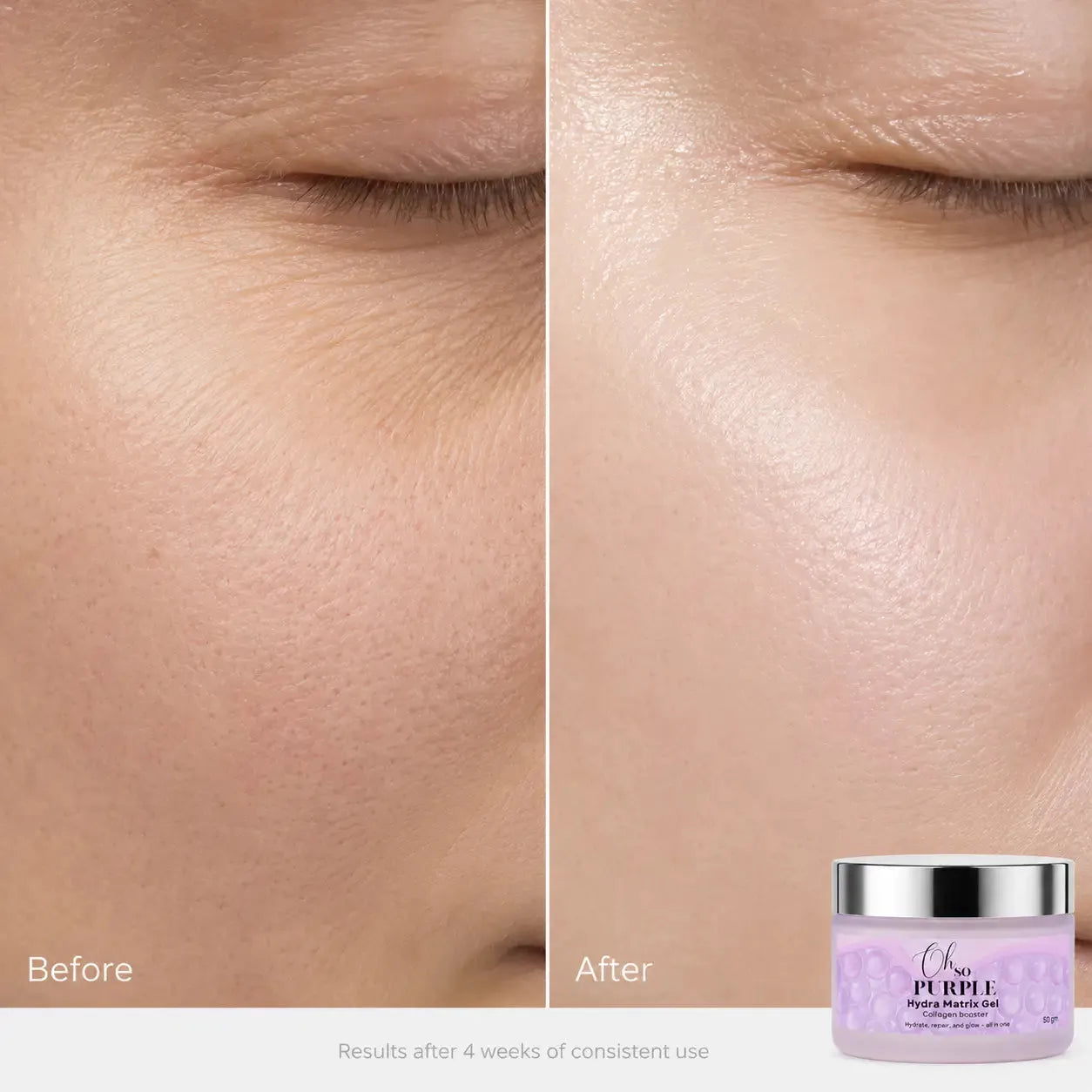 Hydra Matrix Gel - Matrixyl Peptides, Niacinamide (B3), Panthenol (B5), Hyaluronic Acid Collagen Support Gel (50 gm)