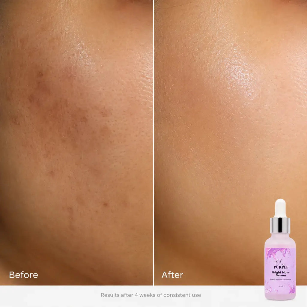 Bright Muse Serum - Vitamin C, Hyaluronic Acid, Vitamin E (30 ml)
